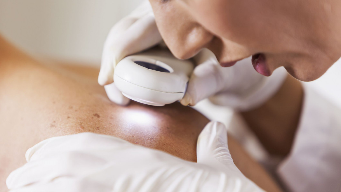 KOŽNÁ AMBULANCIA - DERMATOVENEROLÓGIA